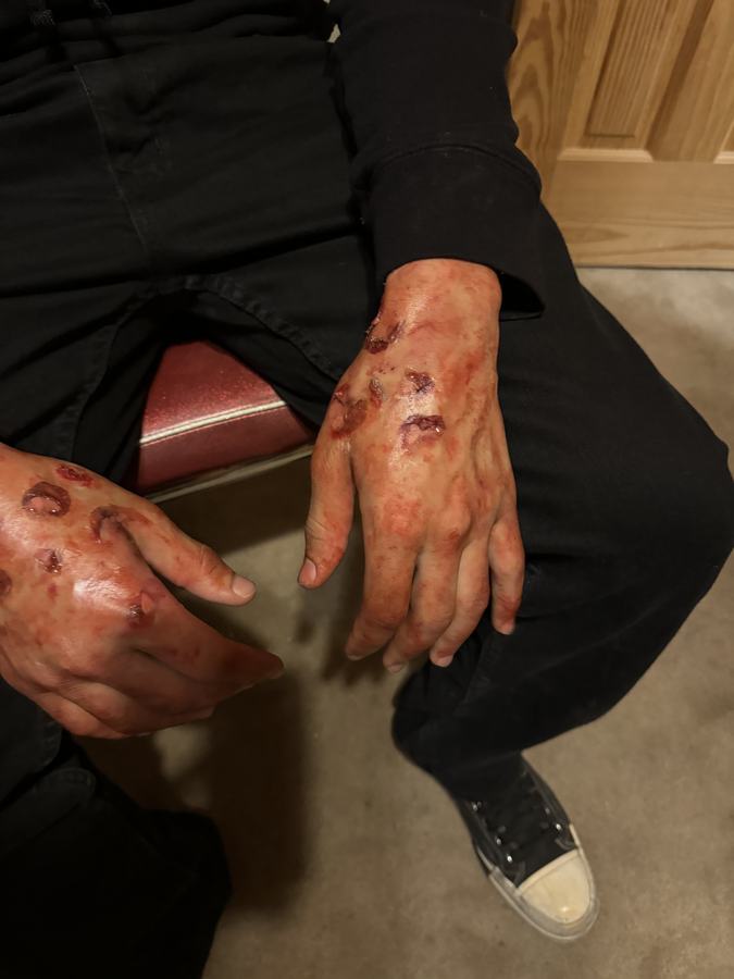 Special effects wound makeup detail